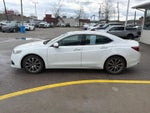 2016 Acura TLX V6 Tech